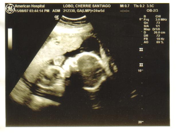 baby23weeks.jpg