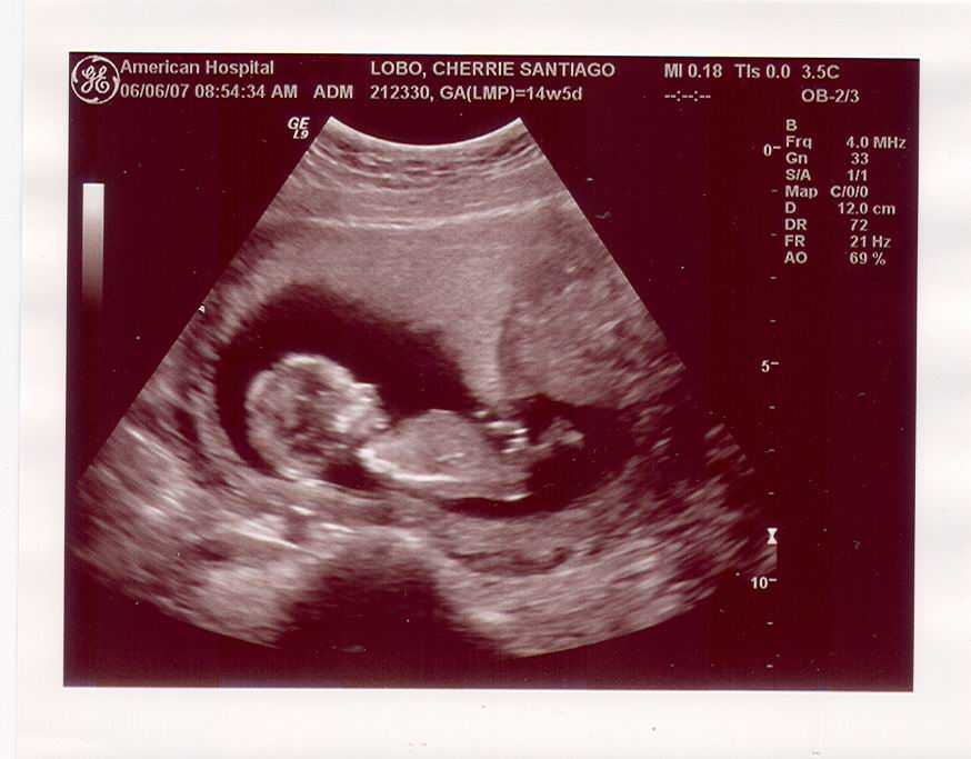 ourbabyat13wks.jpg